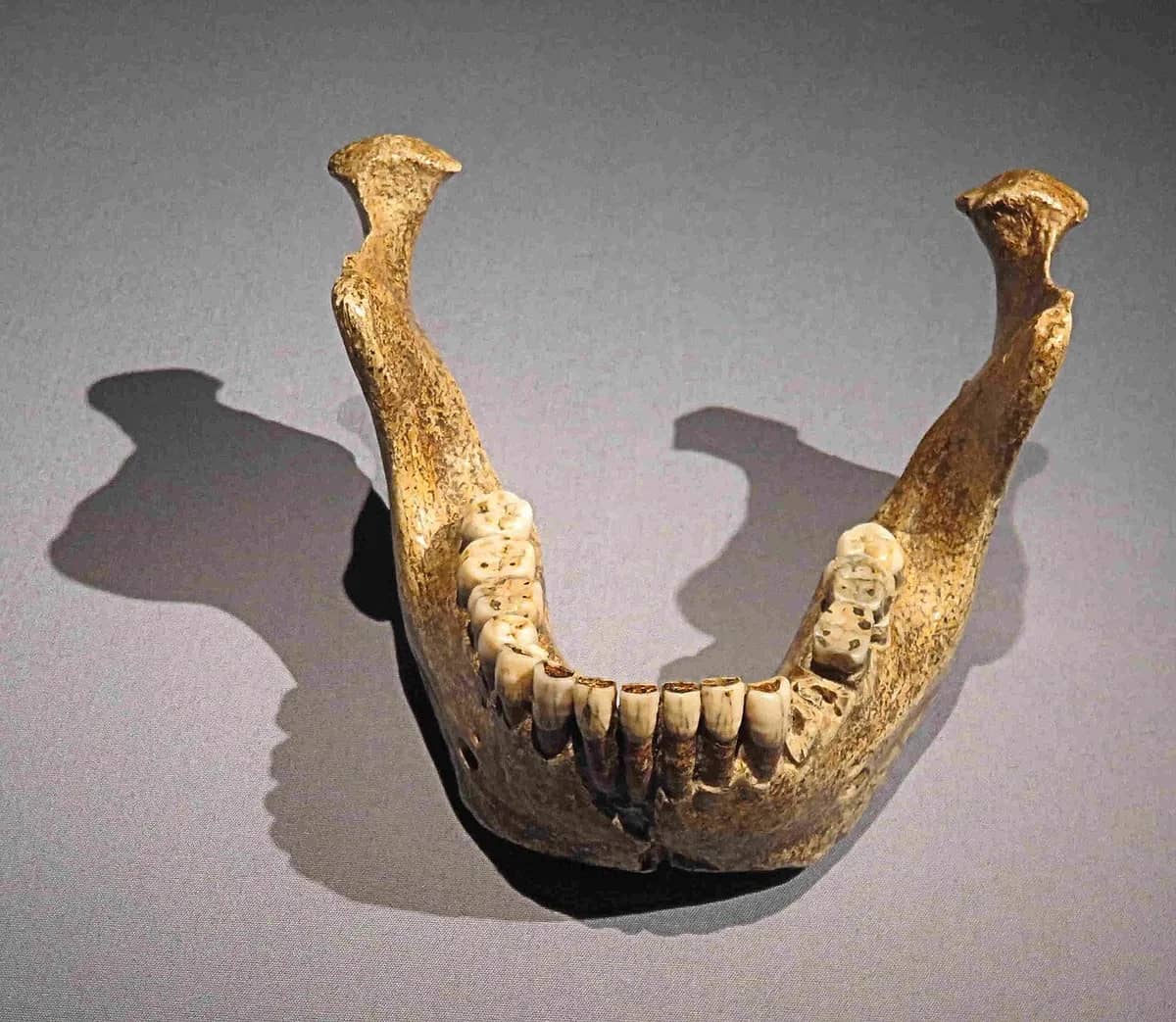 Mandible (lower jaw) of the type specimen of Homo heidelbergenis from Mauer near Heidelberg, Germany (Original)